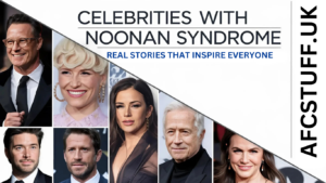 Celebrities With Noonan Syndrome